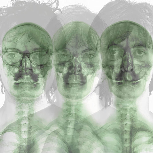Supergrass/Supergrass (Neon Orange Vinyl) [LP]